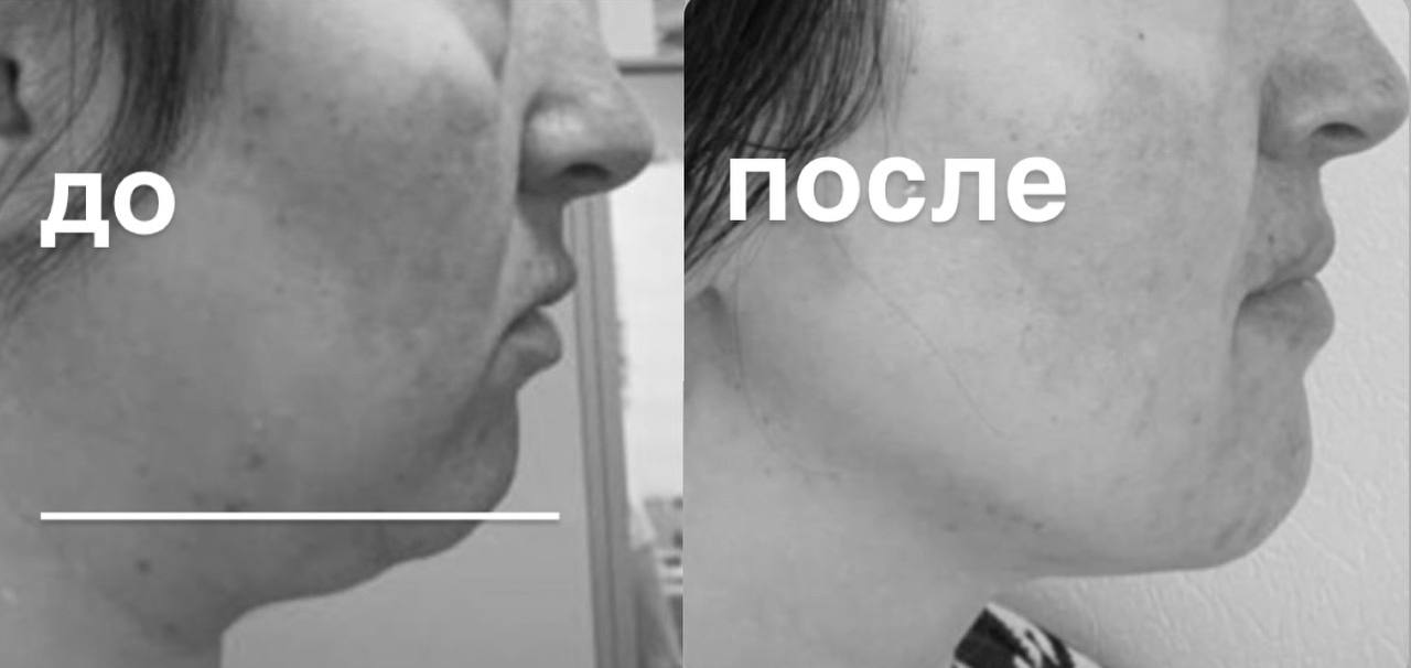 photo_2024-10-11_06_06_27