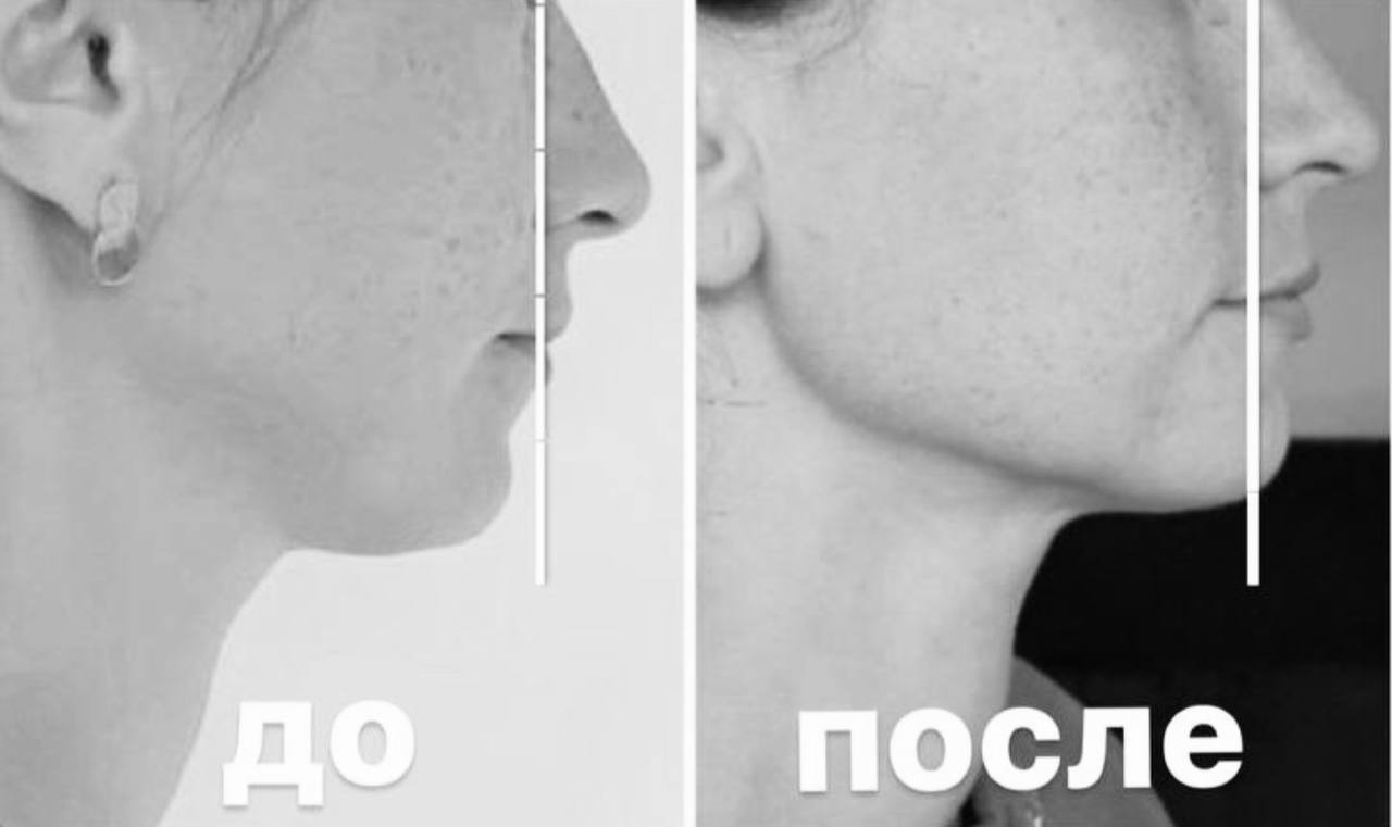 photo_2024-10-11_06_06_38