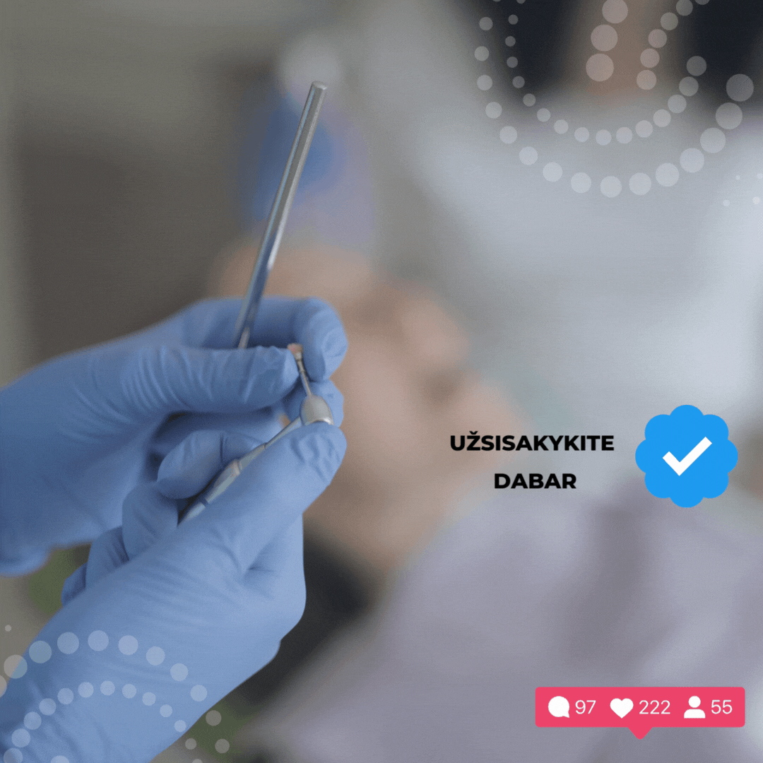 Burnos_higiena_iandiendabar