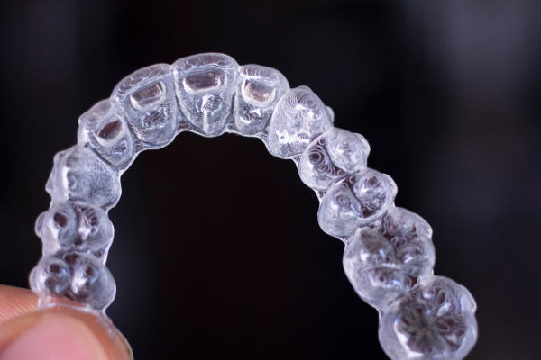 dantų balinimas – saugus ir patogus būdas išlaikyti baltą šypseną