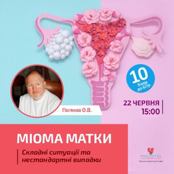 Міома матки