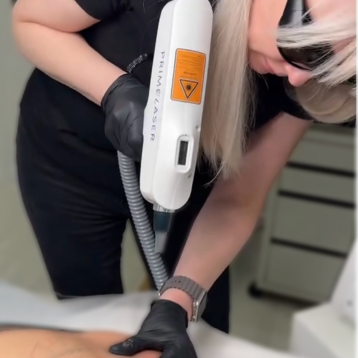 Vidalennya_tatu_remuverom