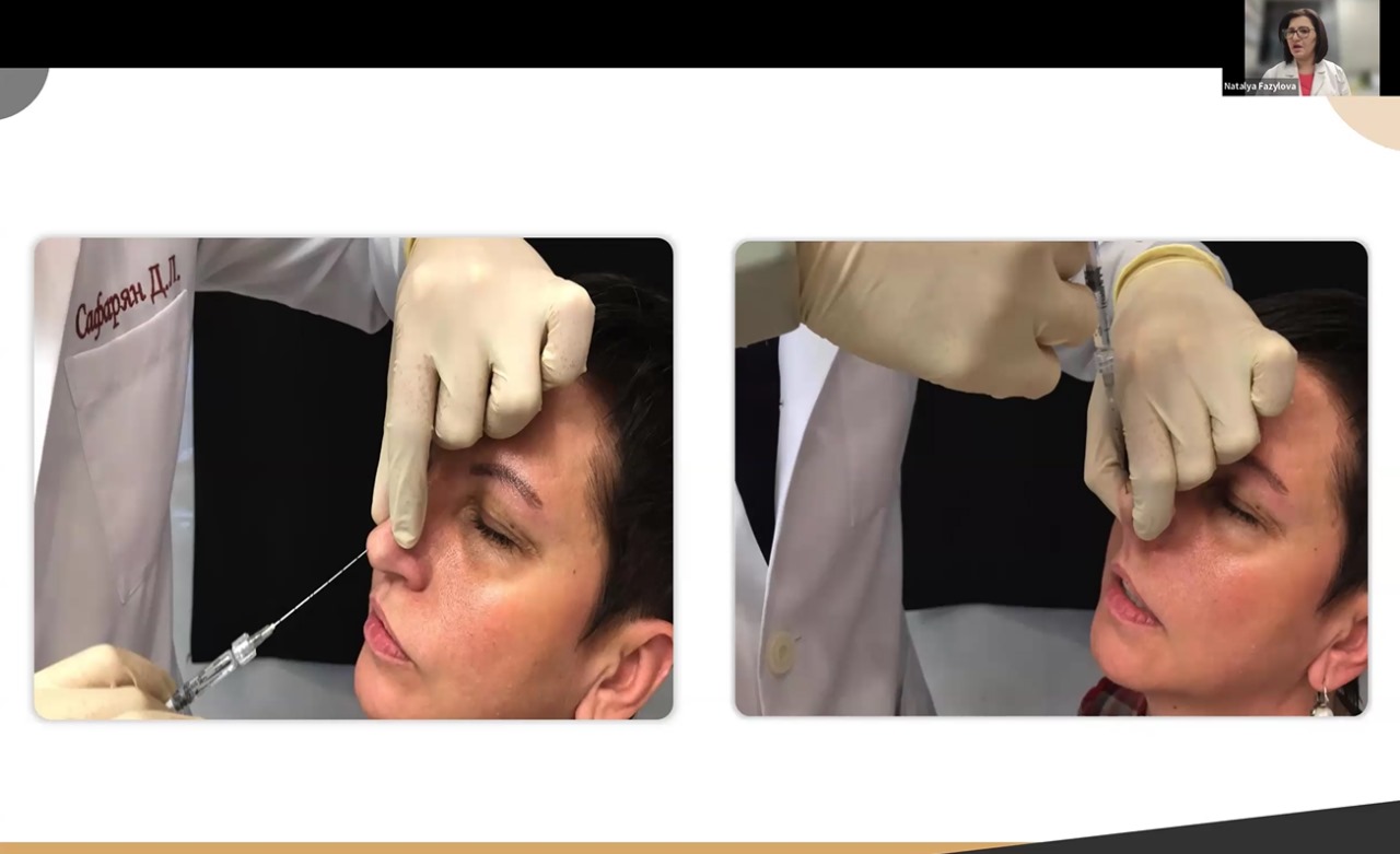 nasal1