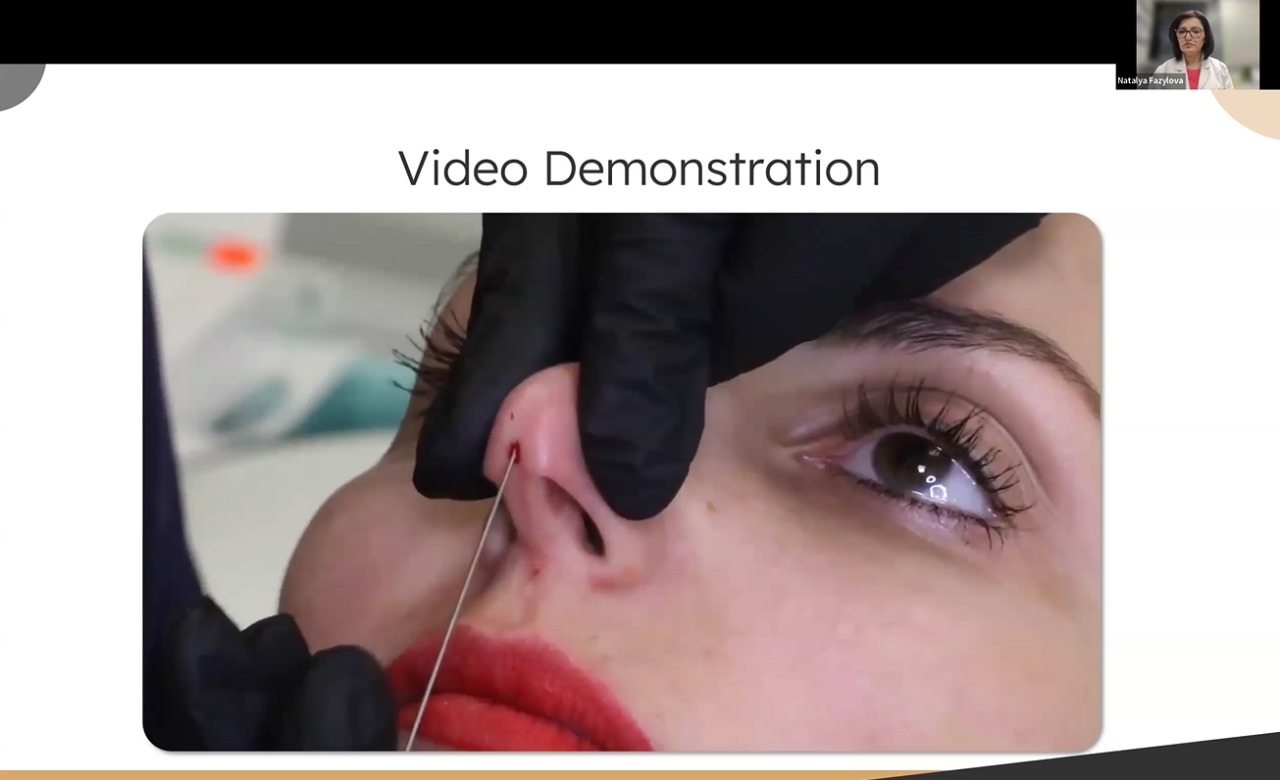 nasal2