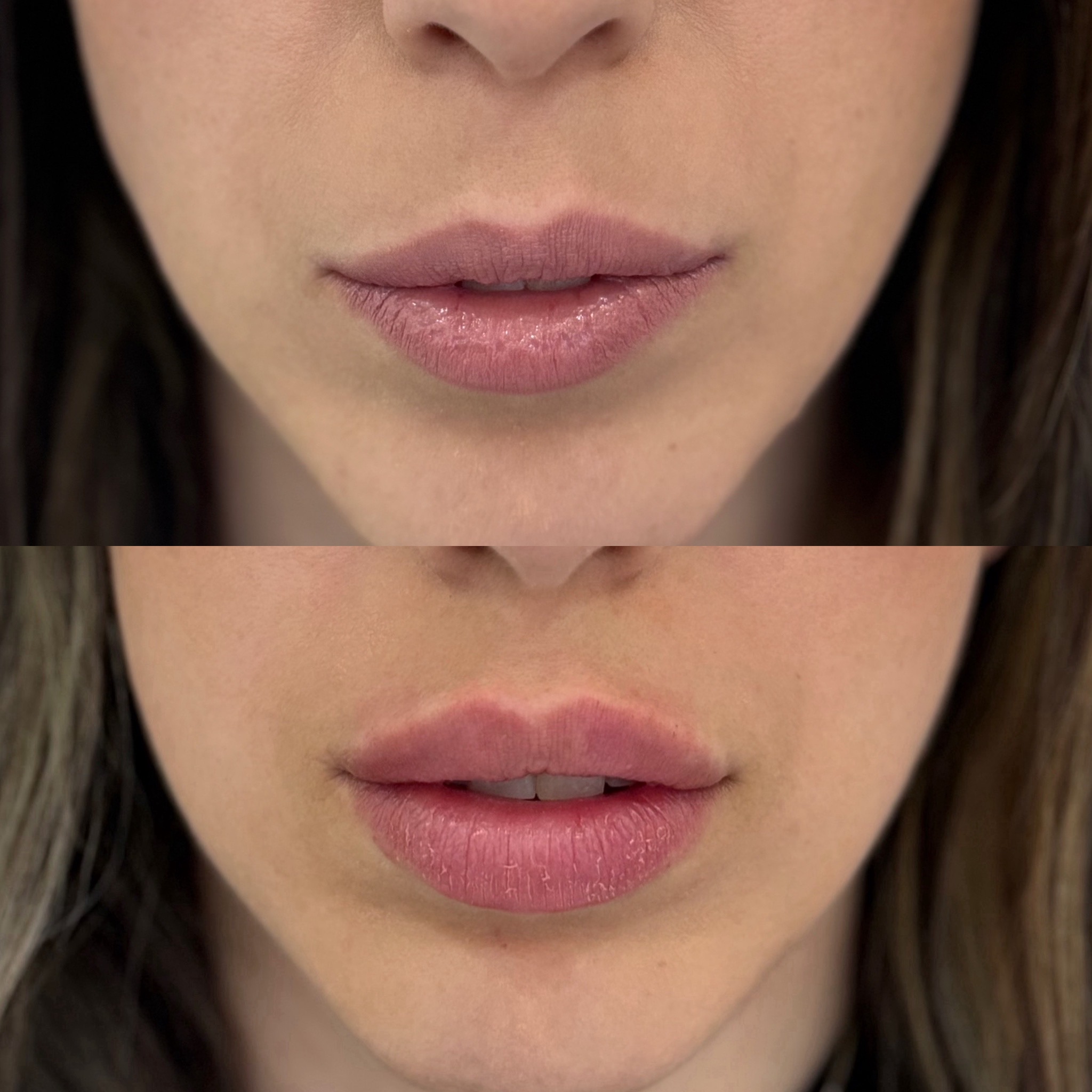 0ECD9A17-3BEE-4E60-A7E7-C54839CEA0B8