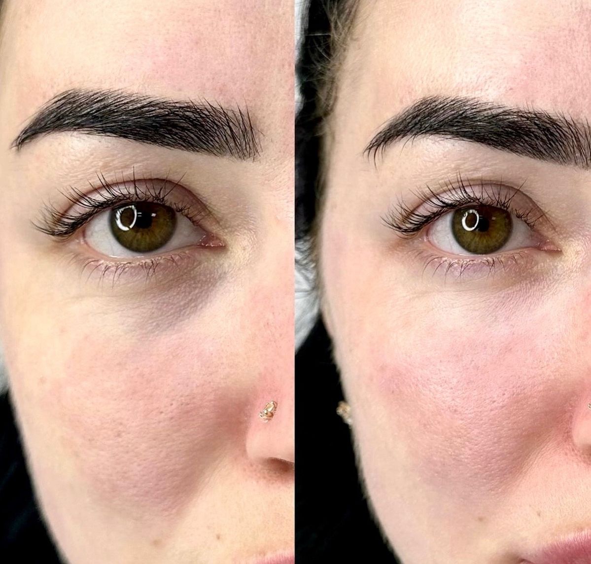 0fa196b3d06383782386597c96fb51b8