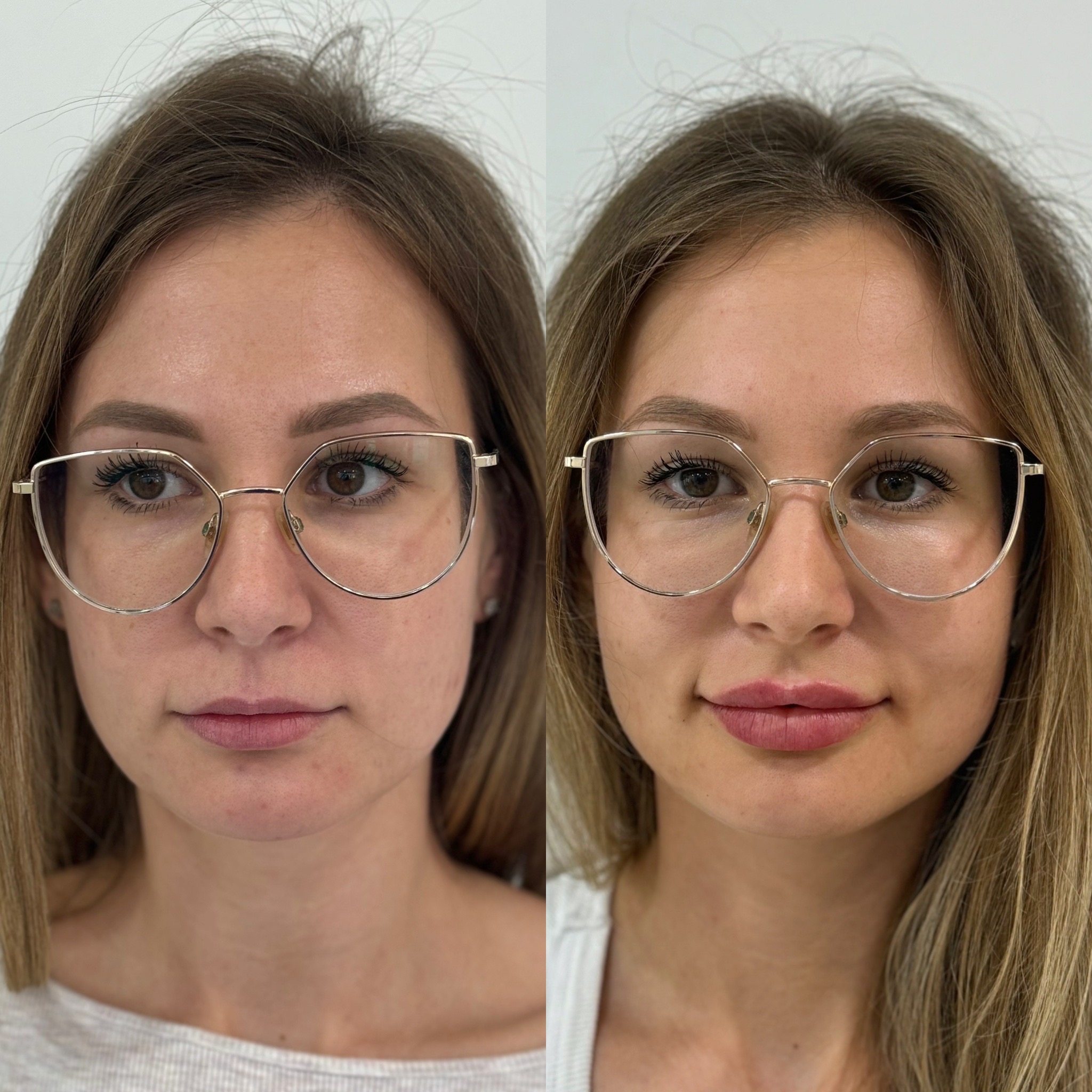 2C8E1C6E-1009-42F0-9EDC-05C66819D66F