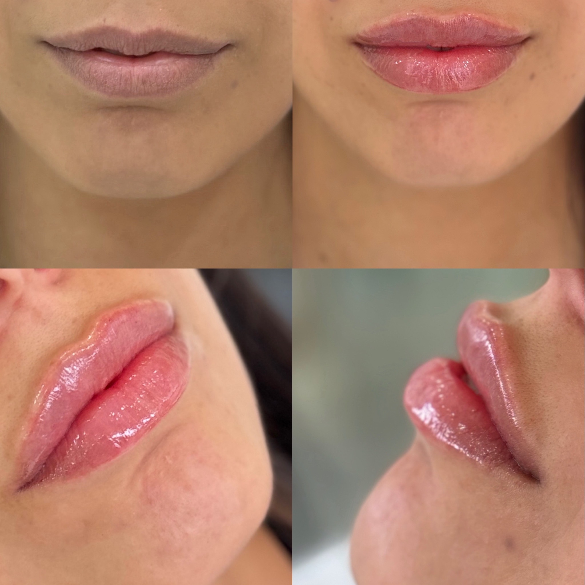 31638446-3478-465D-B718-7F0B059A2C15