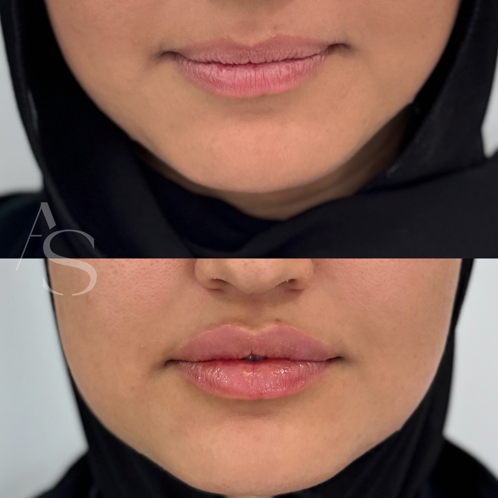 B7C7339F-BB8C-4A91-99A2-5DF24256DE68