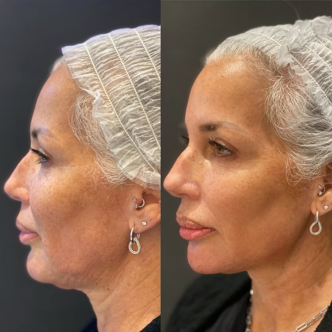 SnapInsta.to_431296206_382189654588107_3117873900616415437_n