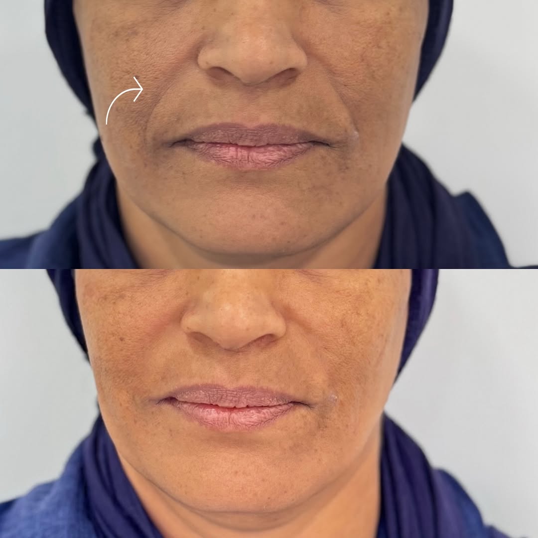 SnapInsta.to_527313254_18077305403480067_2402151210599749744_n