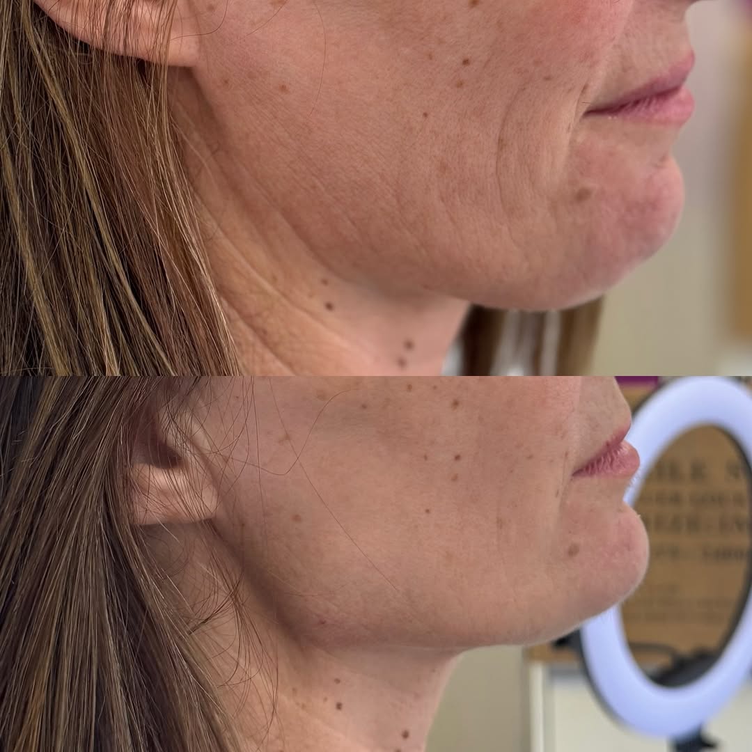 SnapInsta.to_527450542_18077305388480067_4382816899693685955_n