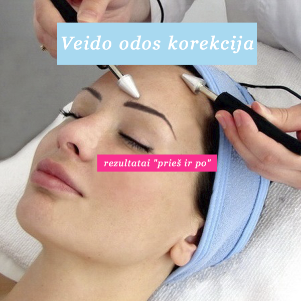 Veido_odos_korekcija_Rezultatai_prie_ir_po