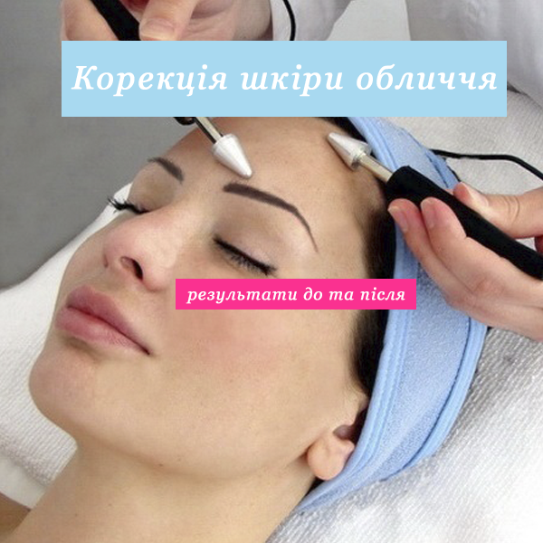 korrektsiya_shkiri_oblichchya_rezultati_do_ta_pislya