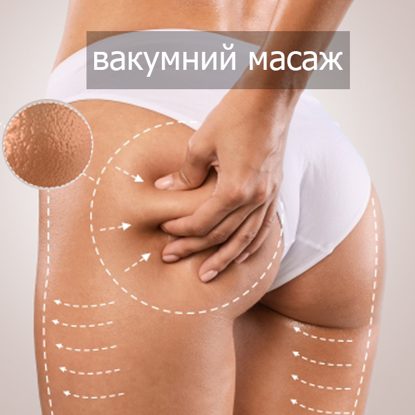 odesa_vakuumniy_masazh