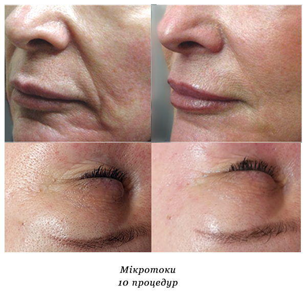 rezultati_mikrotoki_3