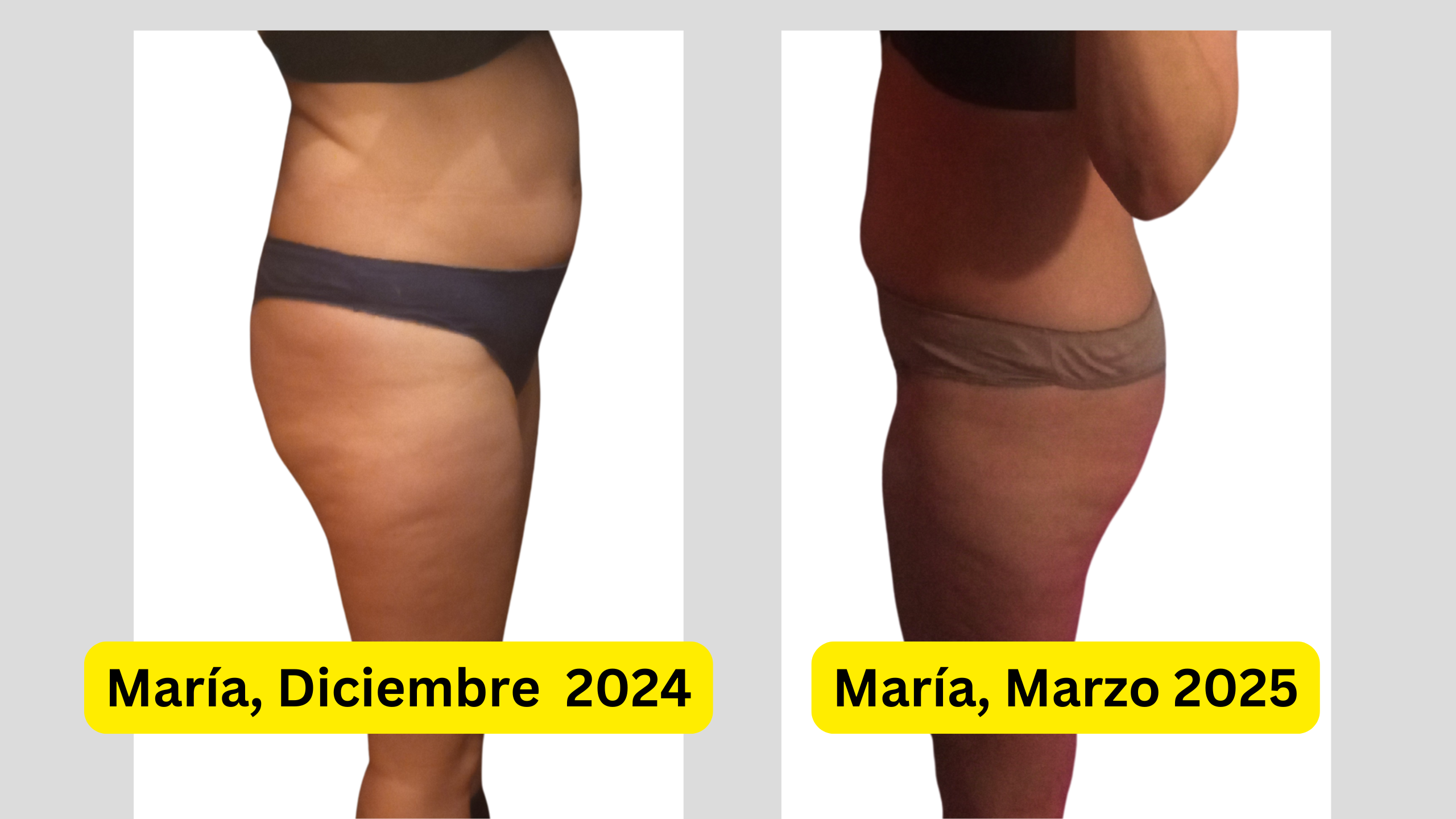 maria_antes_y_despues_keto