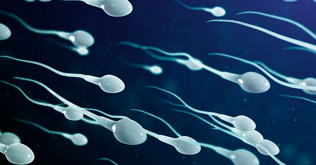 espermatozoide
