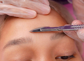 dermaplane