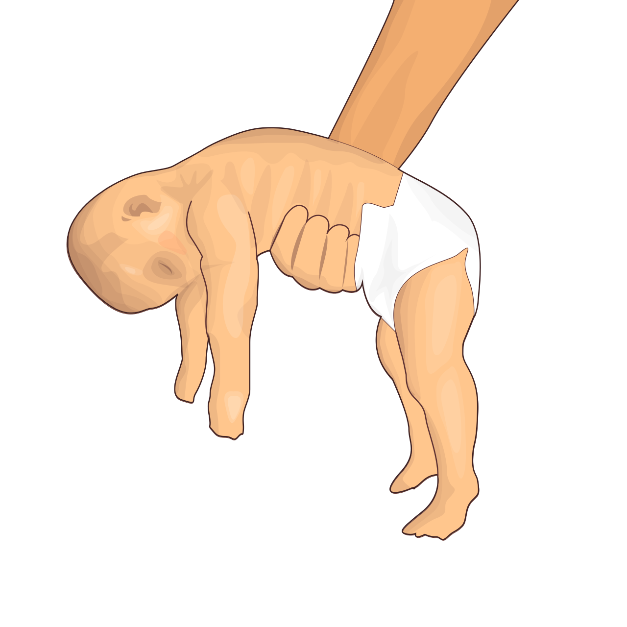 Hypotonia_hariadhi.svg