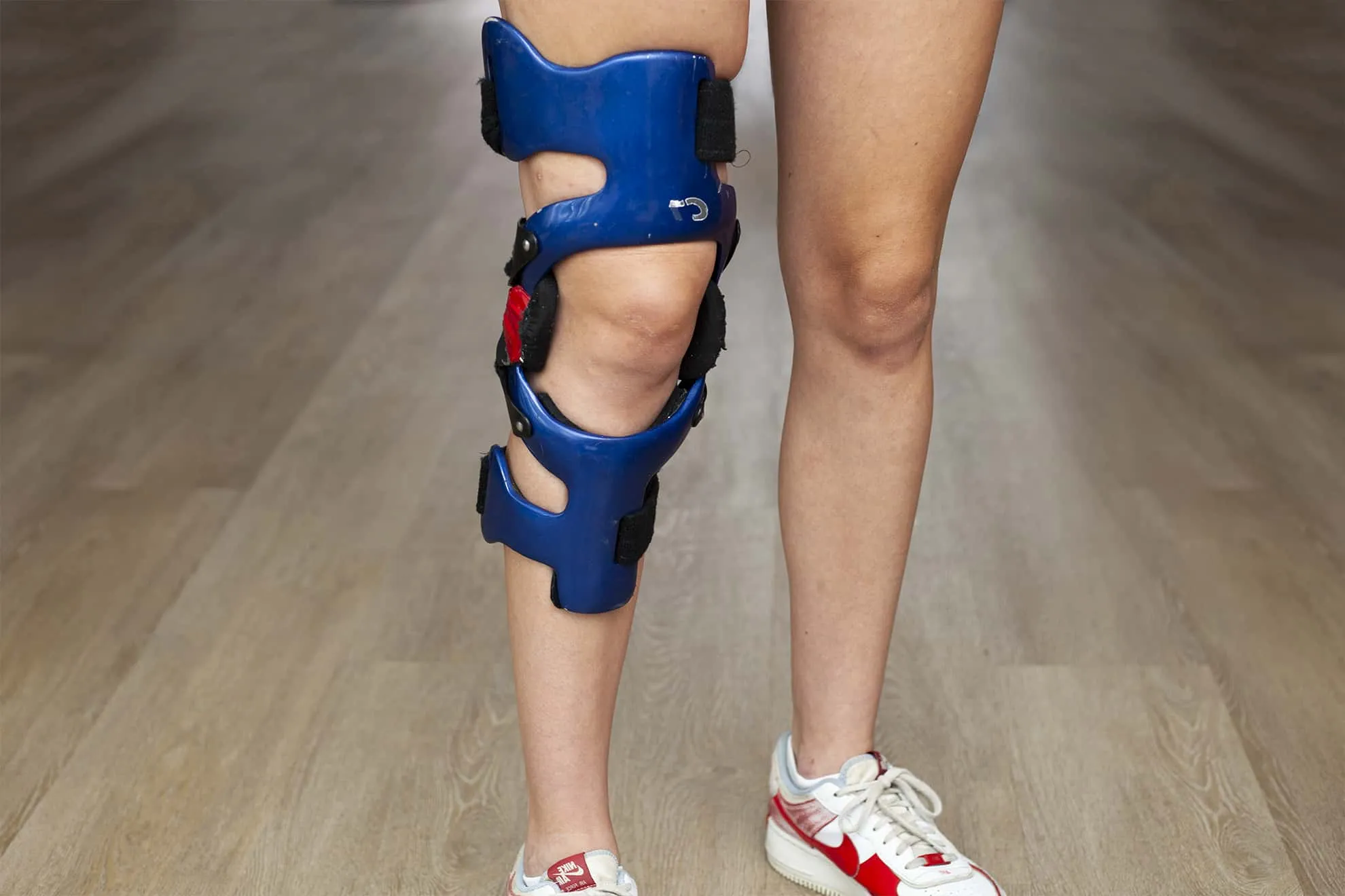 Knieklachten-kruisbandreconstructie-voorachter-01