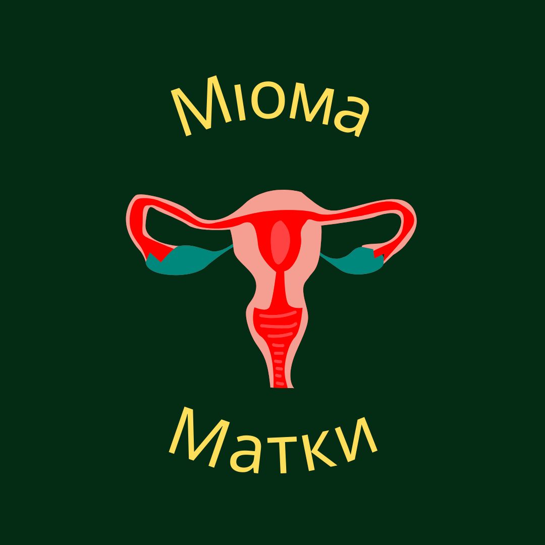 Mioma
