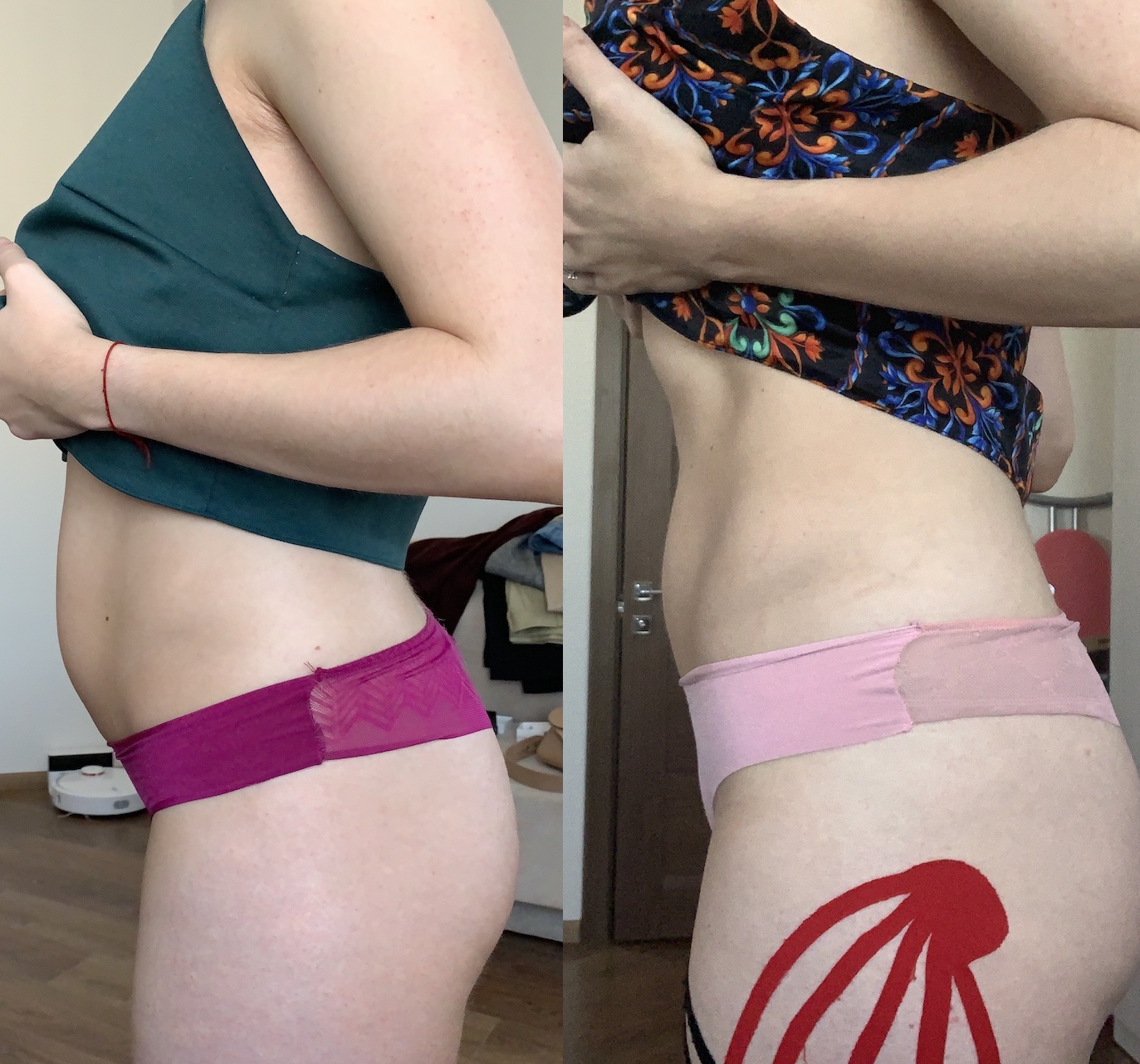 живот-квадрат