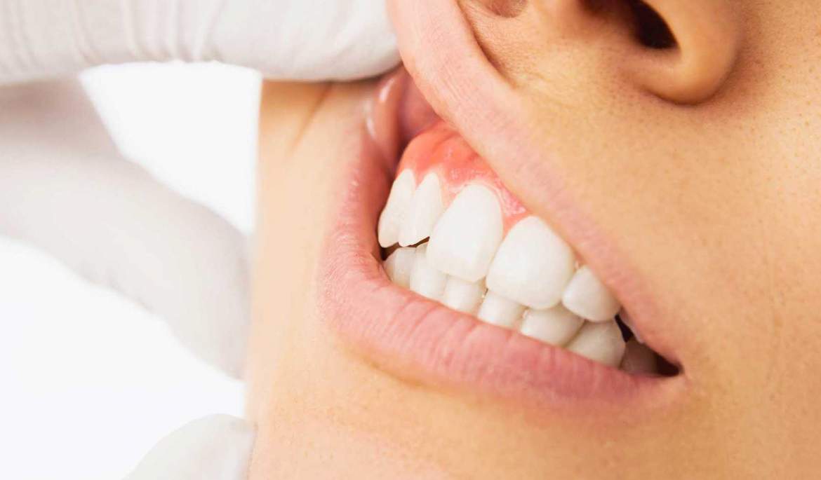 20220912_144018_Opuhla_desna_posle_lecheniya_zuba