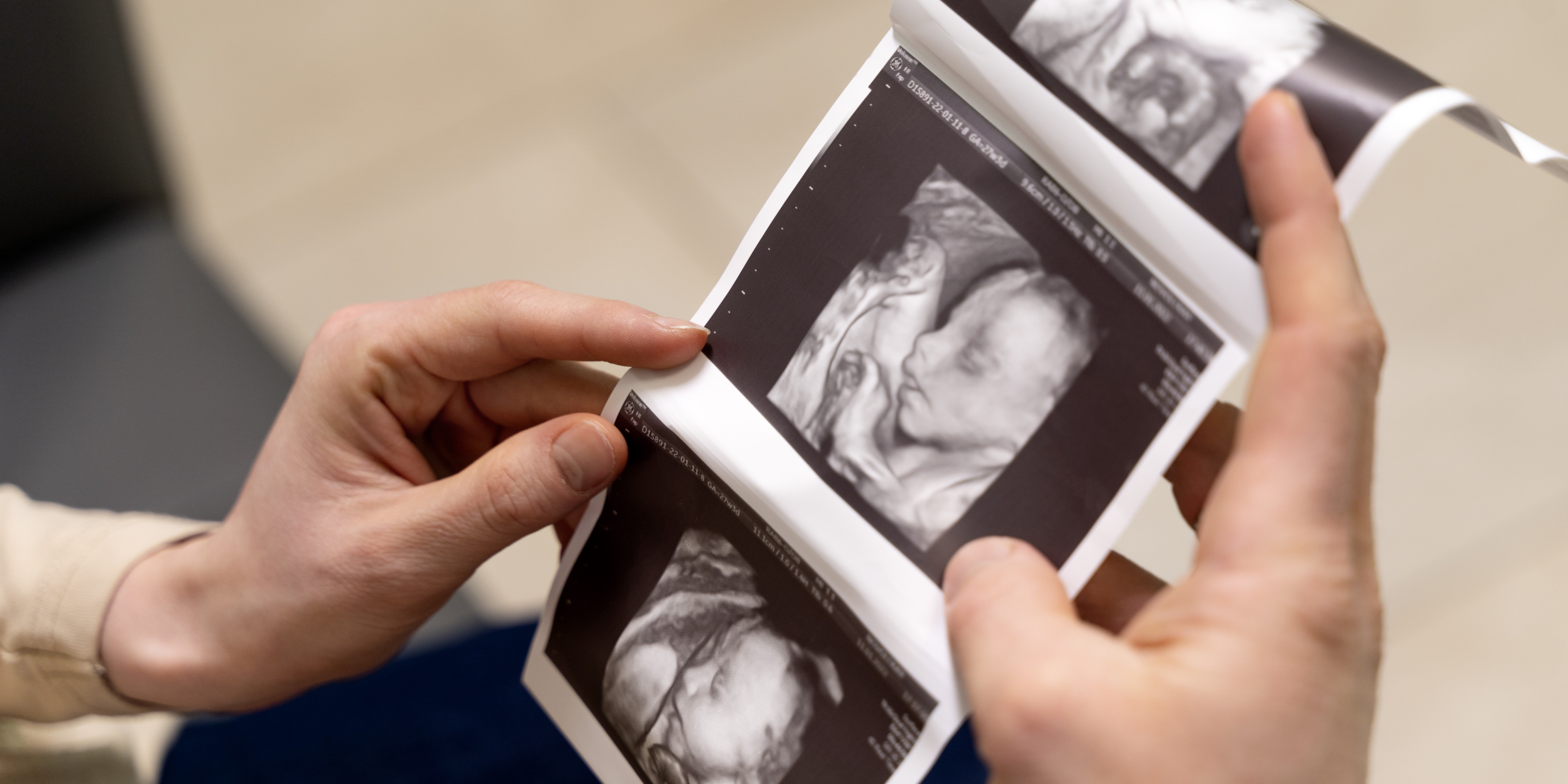 ginecologista-oferecendo-fotos-de-ultrassom-de-casal_2