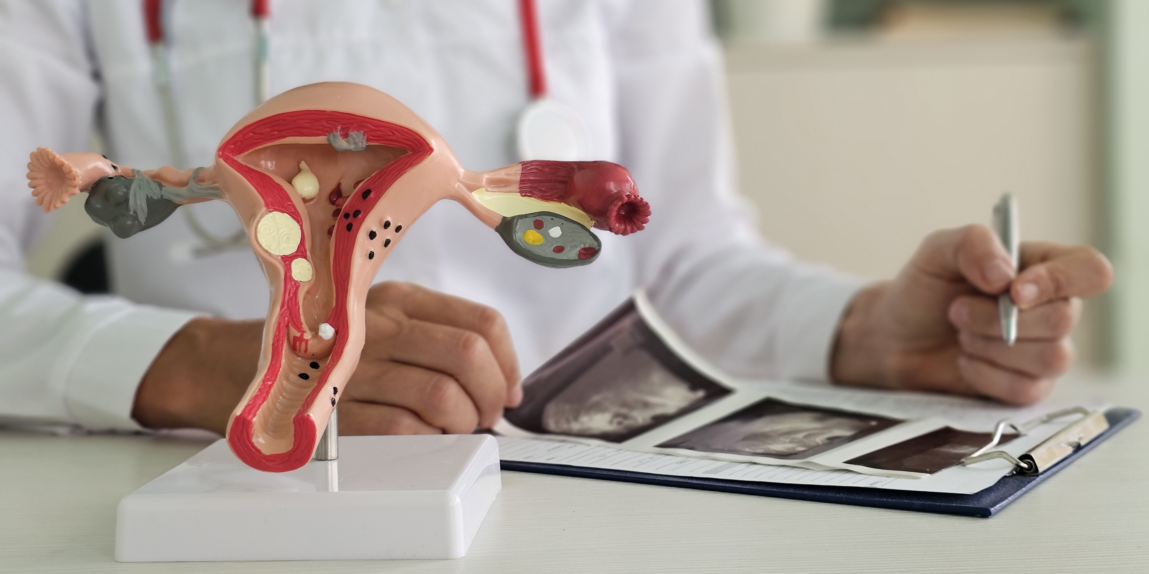 modelo-sistema-reprodutivo-feminino-na-secretaria-medico2